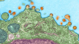 In this image, captured by an electron microscope, HIV (orange) is budding off this CD4 T immune cells (green)